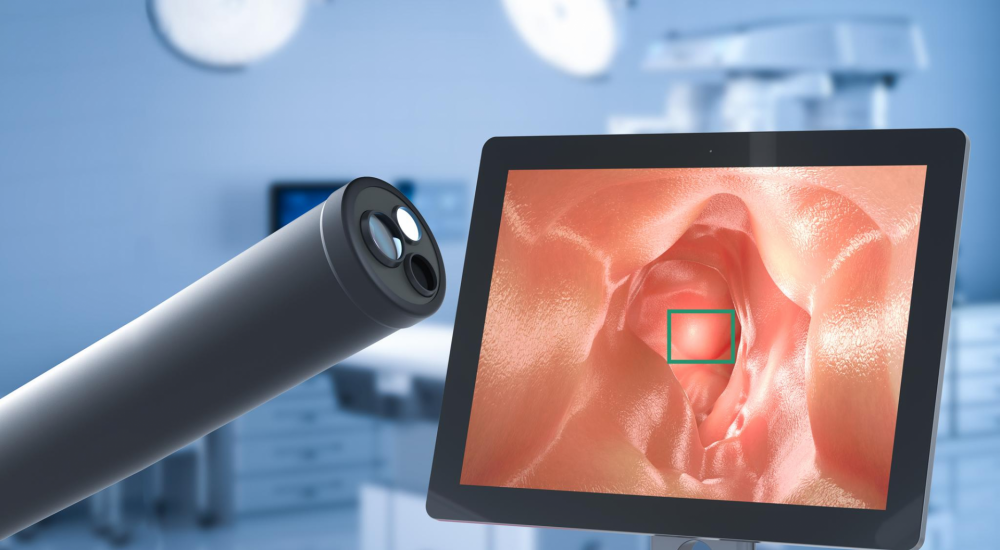 AI in Gastrointestinal Endoscopy Moves from Novelty Toward Routine Practice